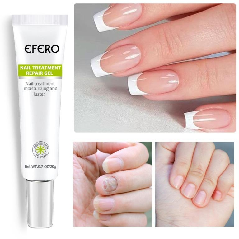 Efero MyCare™ Żel do pielęgnacji paznokci