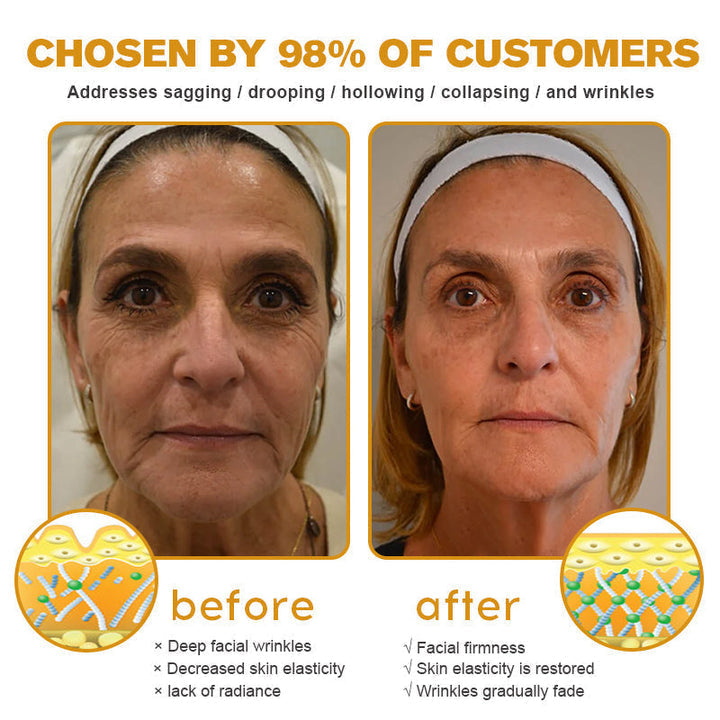 Apitherapy™ Ujędrniający krem do twarzy z jadem pszczelim