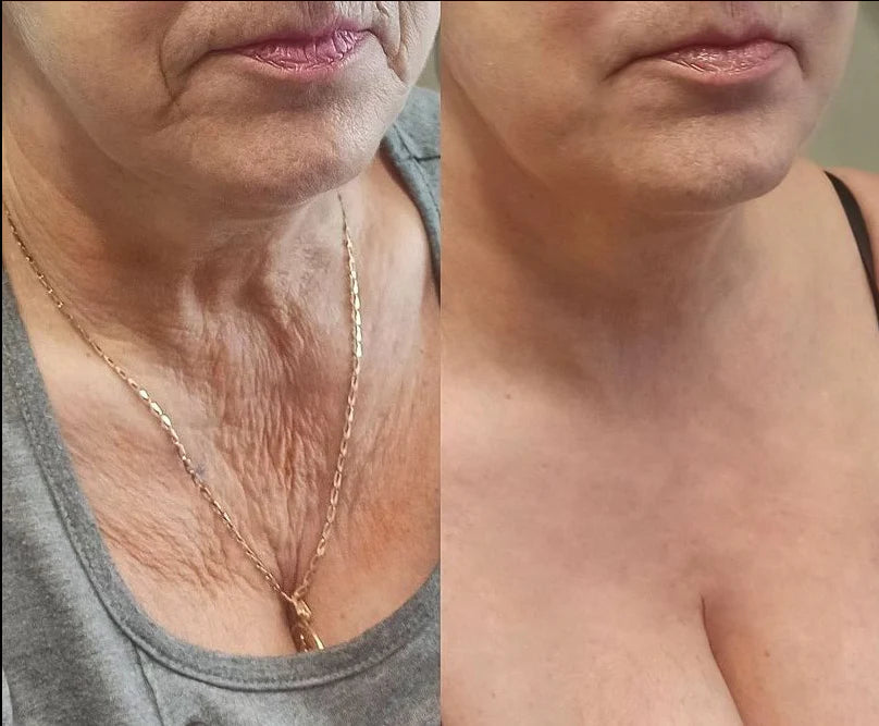 BOTOXIN™ Luksusowy sztyft liftingujący z jadem pszczelim i peptydami