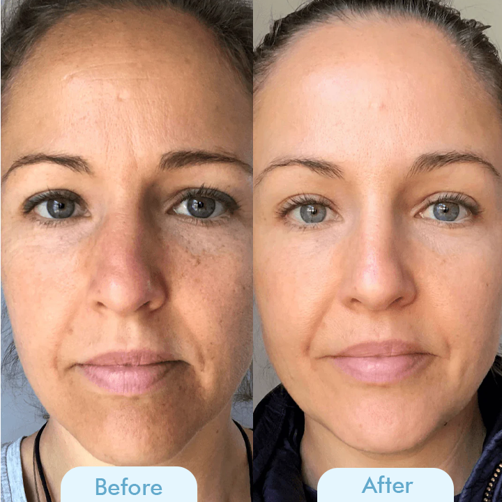 Bio Collagen™ Głęboka maska dla gładkiej skóry
