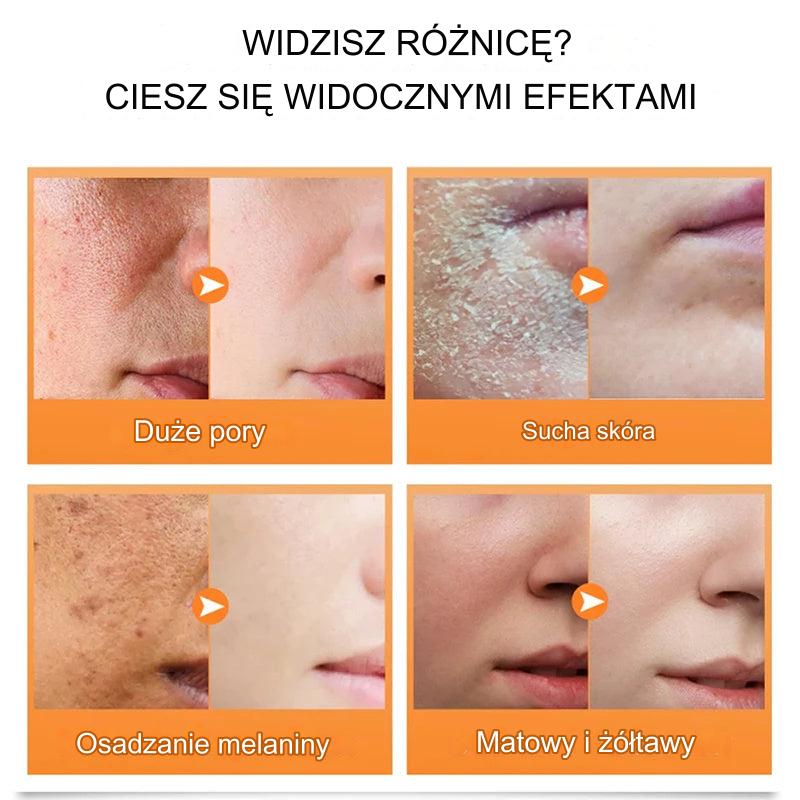 Bonatura+™️ Serum do twarzy z kurkumą | Odśwież swoją skórę i pozbądź się ciemnych plam na stałe!