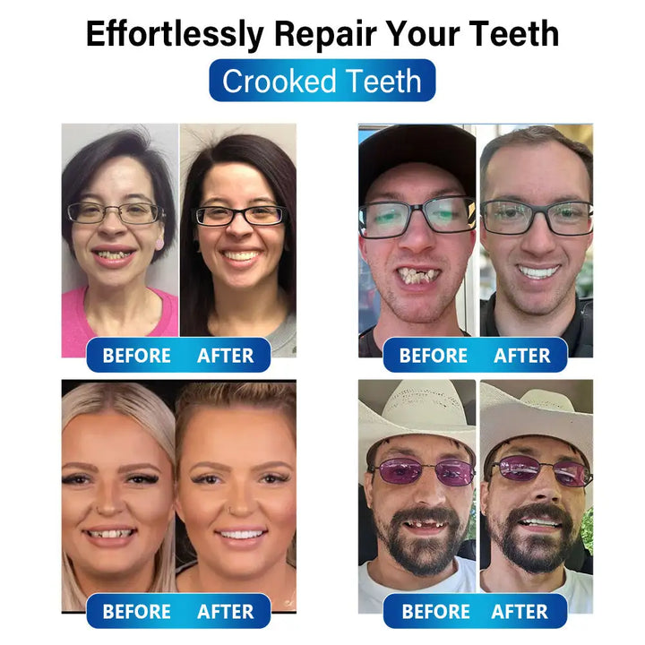 DentBlue™ Lampa utwardzająca światłem niebieskim i materiał do naprawy zębów