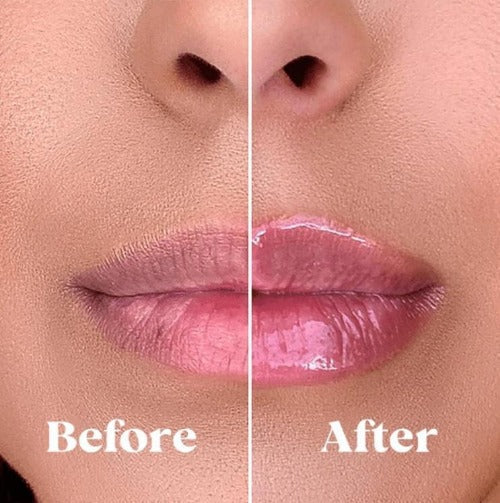 Derol JuicyLips™ Serum ujędrniające do ust