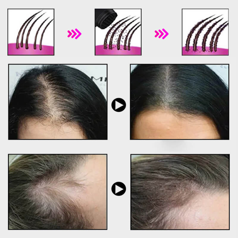 EELHOE HAIR™  Puder przeciw wypadaniu włosów i szybkie wypełnienie linii włosów