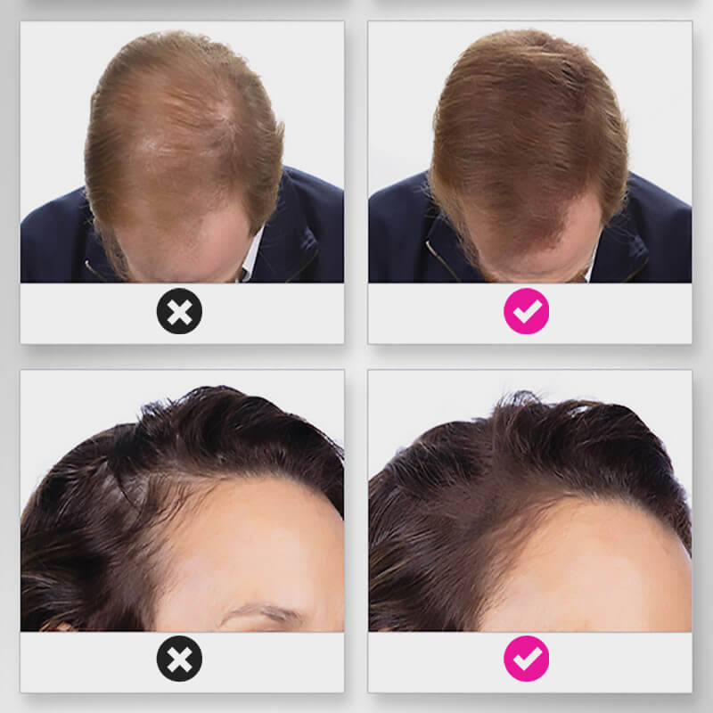 EELHOE HAIR™  Puder przeciw wypadaniu włosów i szybkie wypełnienie linii włosów