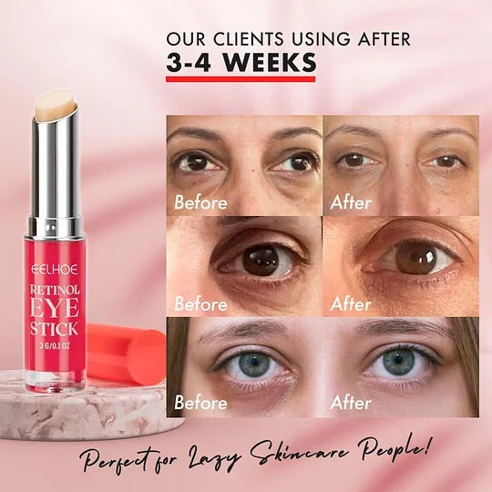 EELHOE Stick™ Krem pod oczy w sztyfcie, z retinolem