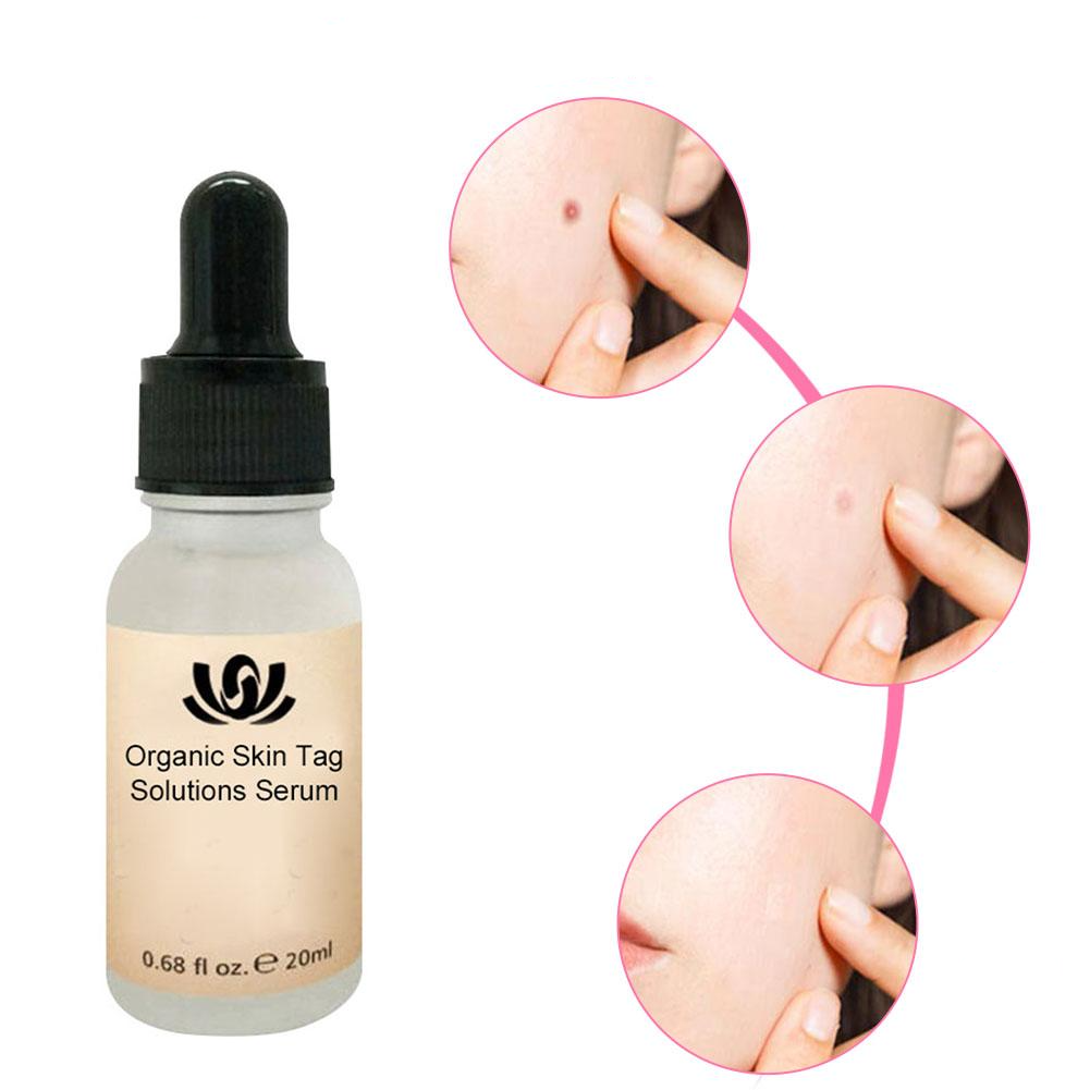 HerbCare™ Organiczne serum na skazy skórne | Usuń trwale brzydkie plamy skórne!