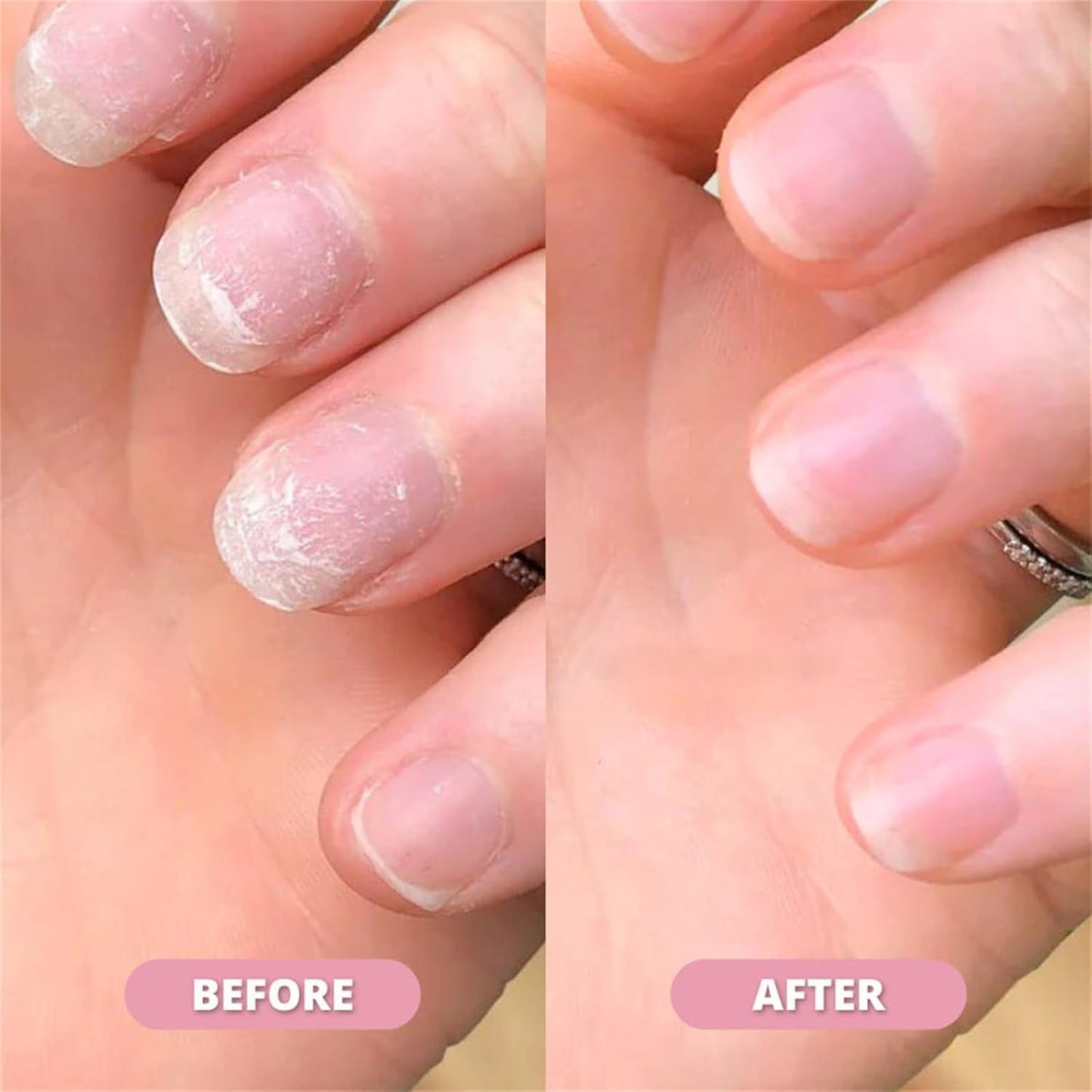Nailora™ Olejek wzmacniający paznokcie