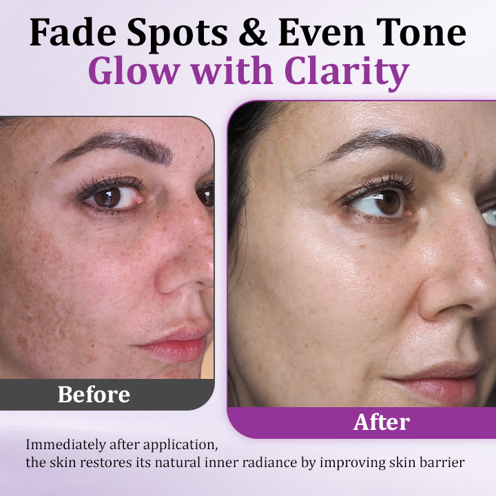 NicoGlow™ Rozjaśniające serum do skóry