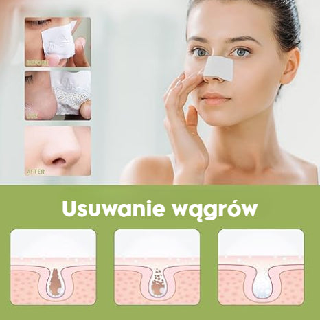LANBENA™ Złuszczająca maska do usuwania zaskórników z 60 paskami