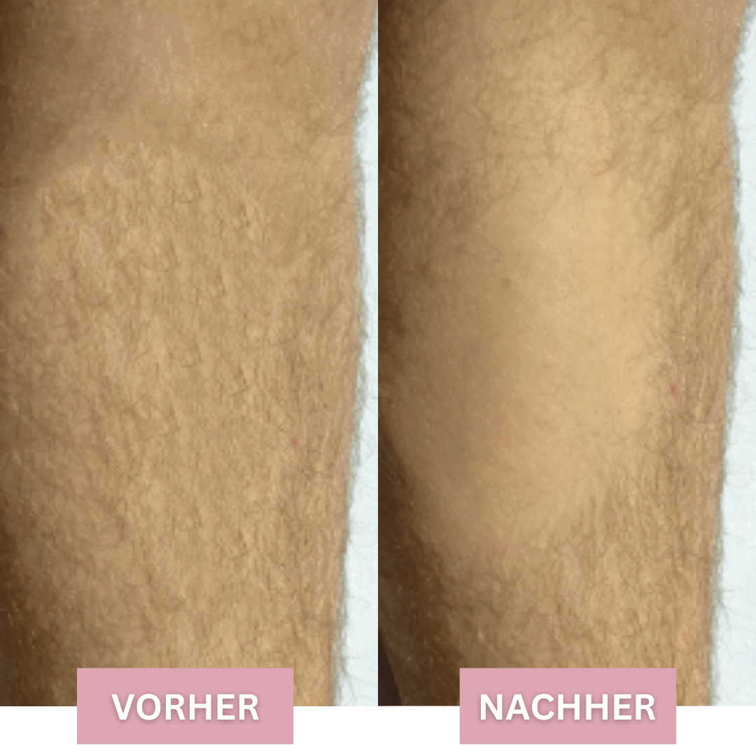 Silken Skin+™ Urządzenie do usuwania włosów | Bezbłędna gładkość na długi czas