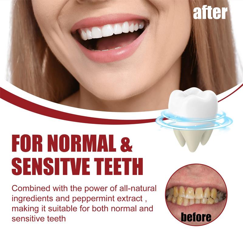 Vital Smile+™ Pasta do zębów Super Probiotic-6 z 6 probiotykami | Odzyskaj równowagę w ustach już po pierwszym użyciu!