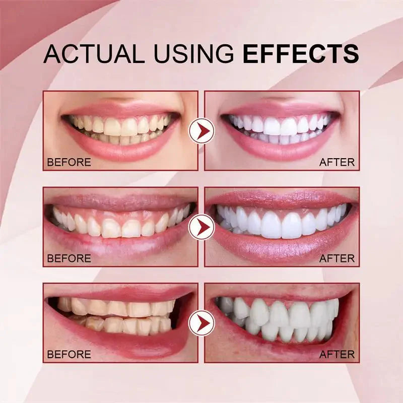 Vital Smile+™ Pasta do zębów Super Probiotic-6 z 6 probiotykami | Odzyskaj równowagę w ustach już po pierwszym użyciu!