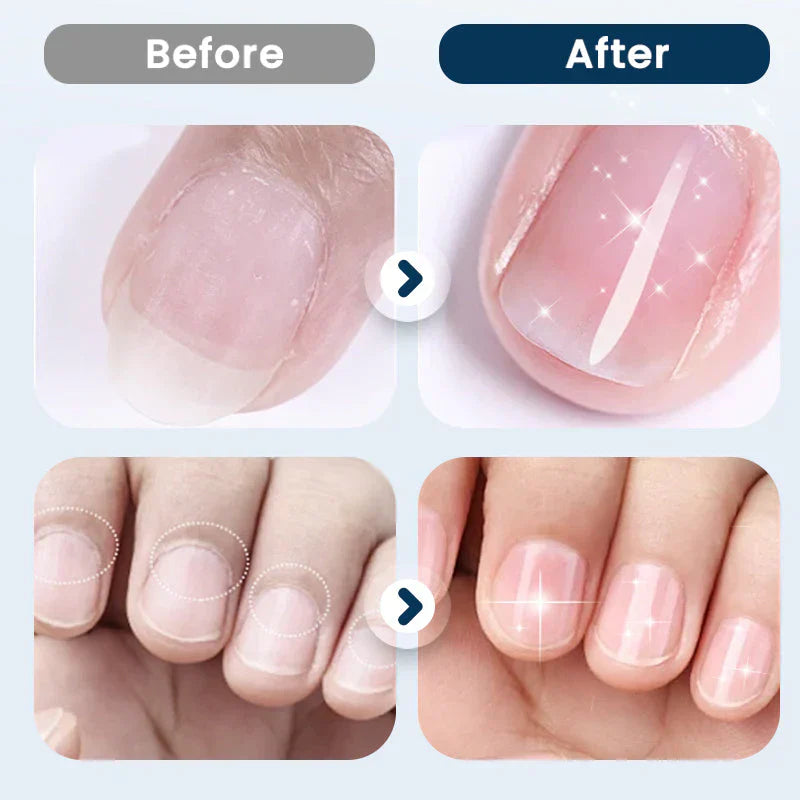 NourishNails™ Odżywczy spray regenerujący dla gładkich i zdrowych paznokci